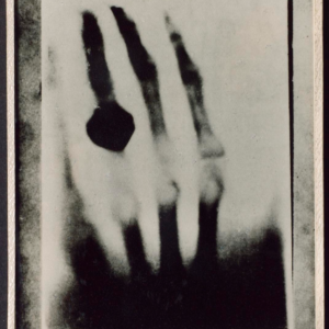 Konrad Röntgens hand