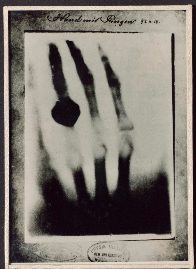 Konrad Röntgens hand
